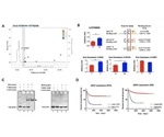 Highly expressed DDX1 gene is associated with poor survival of neuroblastoma