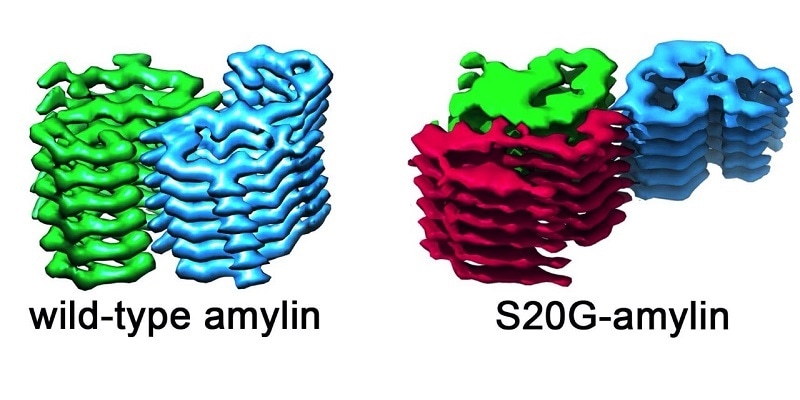 Scientists identify the structure of protein fiber associated with early-onset type 2 diabetes