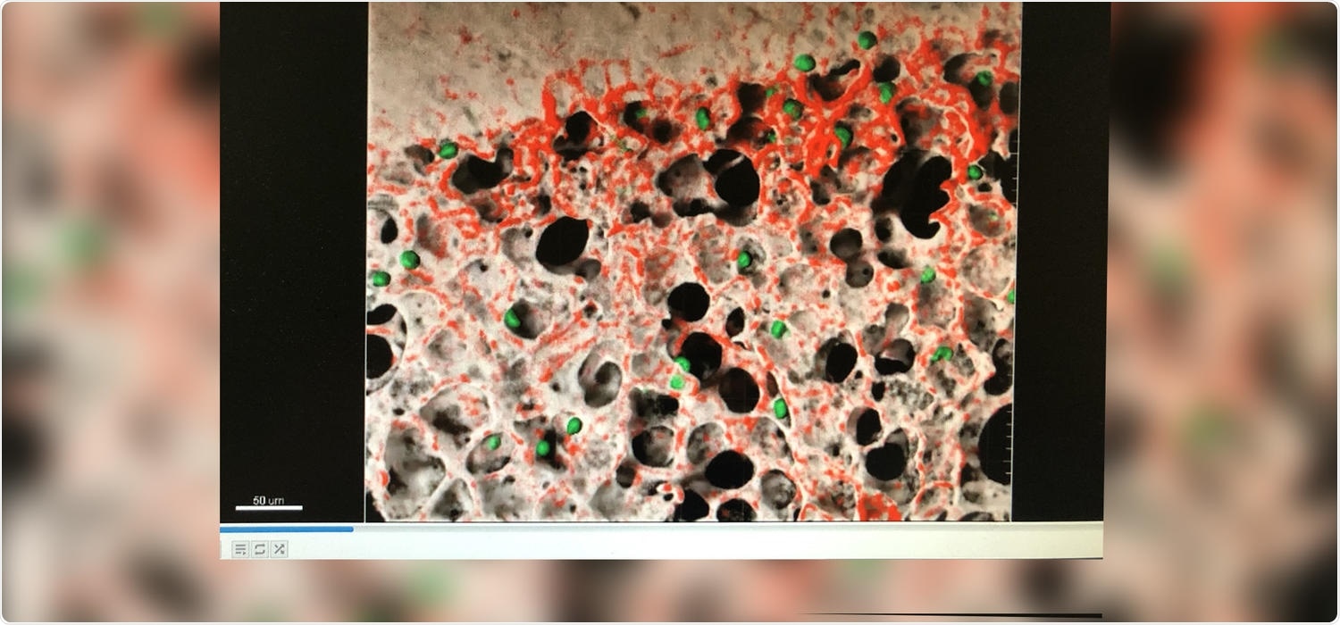 Study shows a new way to capture “live” images of immune cells inside the lungs