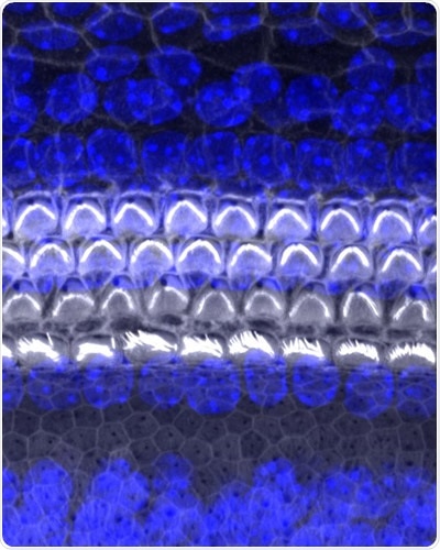 Study may lead to future treatments for hearing loss