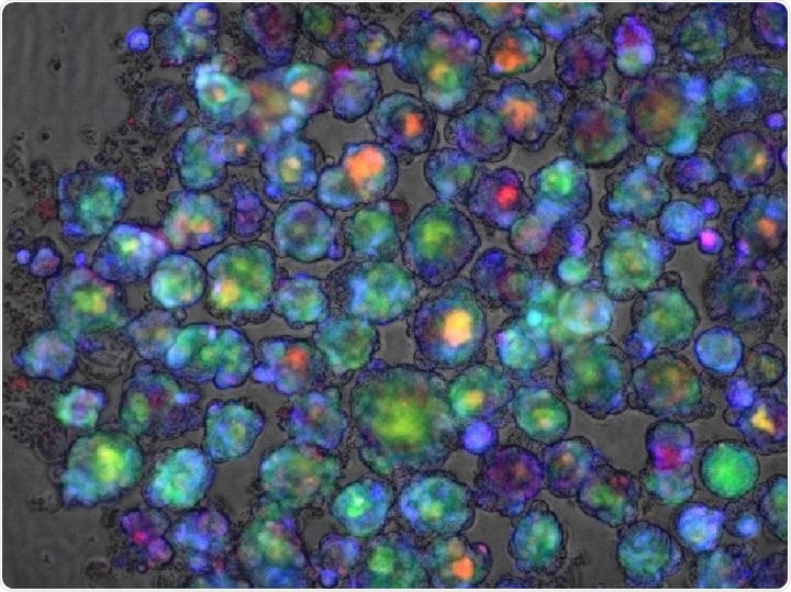 New gene test predicts risk of drug-induced liver injury