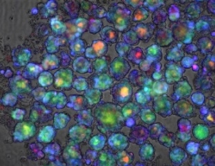 New gene test predicts risk of drug-induced liver injury