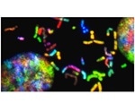 New mathematical tools reveal the evolution and spread of tumors