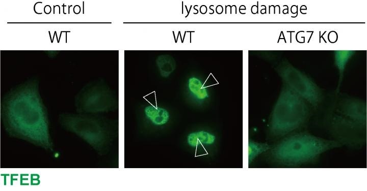 Study reveals pathways essential for preventing crystal-induced kidney injury