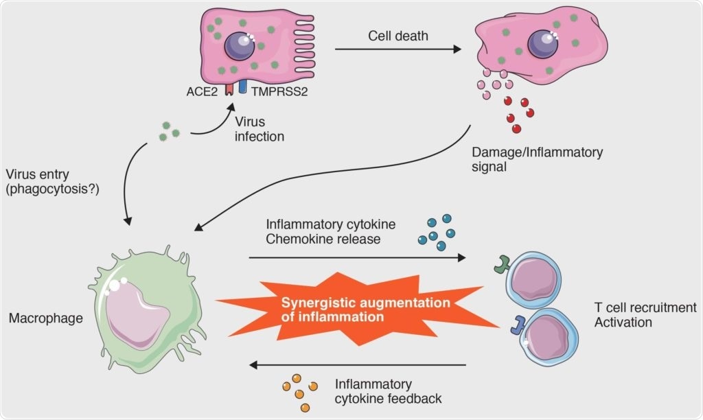 Researchers review the role of macrophage activation syndrome in COVID-19