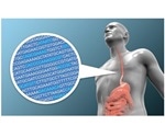 Researchers develop statistical model that predicts risk of developing esophageal cancer
