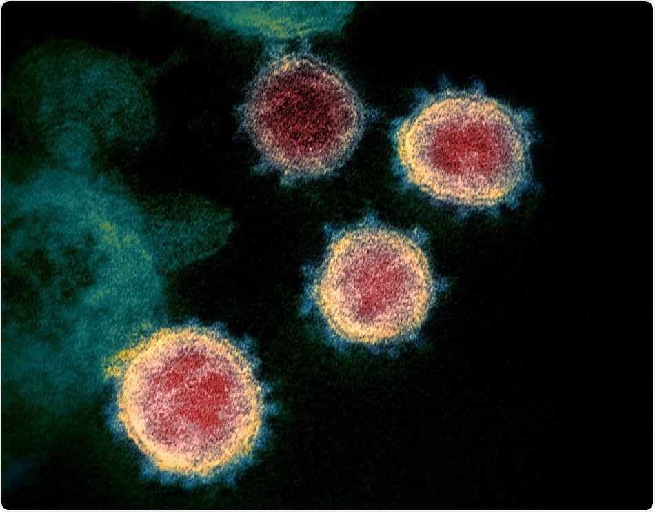 Genetic variations may not contribute to mortality and morbidity of COVID-19