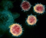 Genetic variations may not contribute to mortality and morbidity of COVID-19