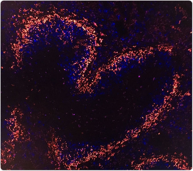 Study pinpoints specific protein involved in the mass production of antibodies