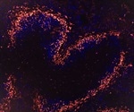 Study pinpoints specific protein involved in the mass production of antibodies