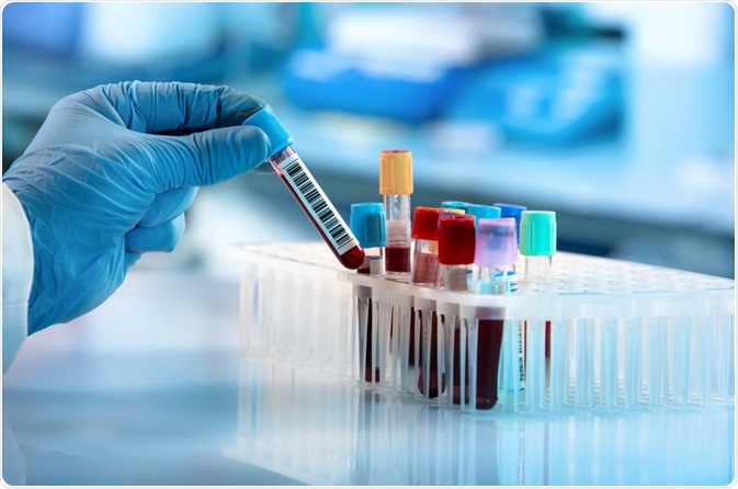 Blood Test Blood Test