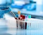 Detecting Drug Levels in Blood