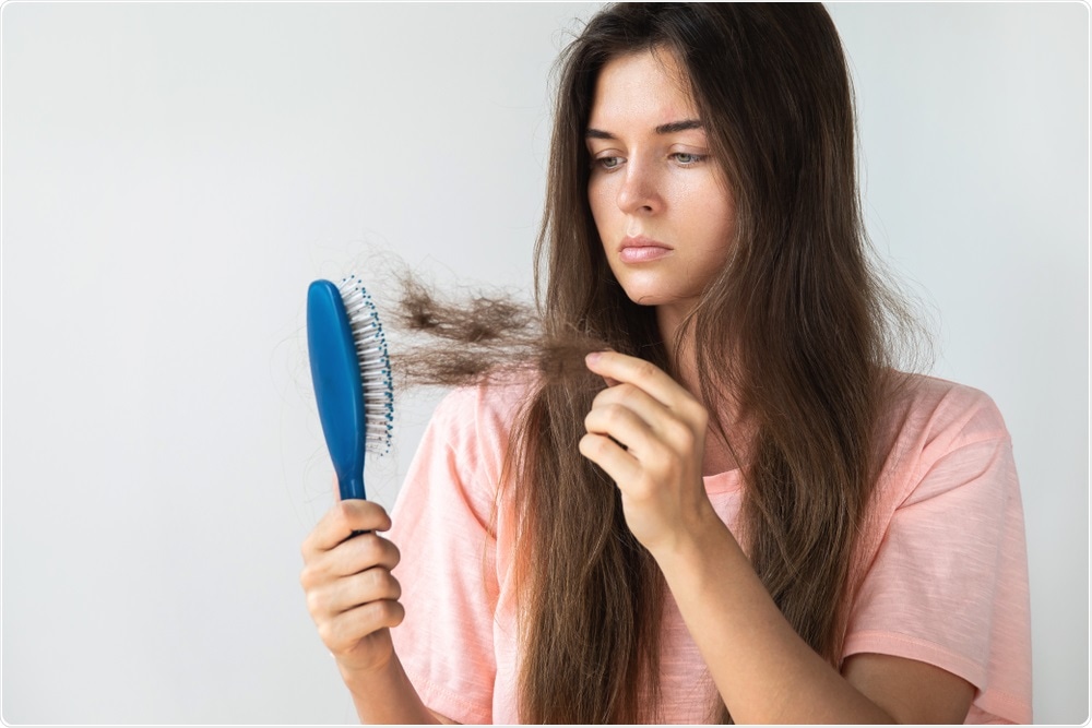 Hair Loss Hair Loss