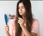 Fine-tuning stem cell metabolism prevents hair loss