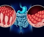 Early introduction of gluten may prevent coeliac disease in children