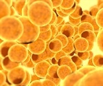 Genetic differences in body fat shape men and women's health risks