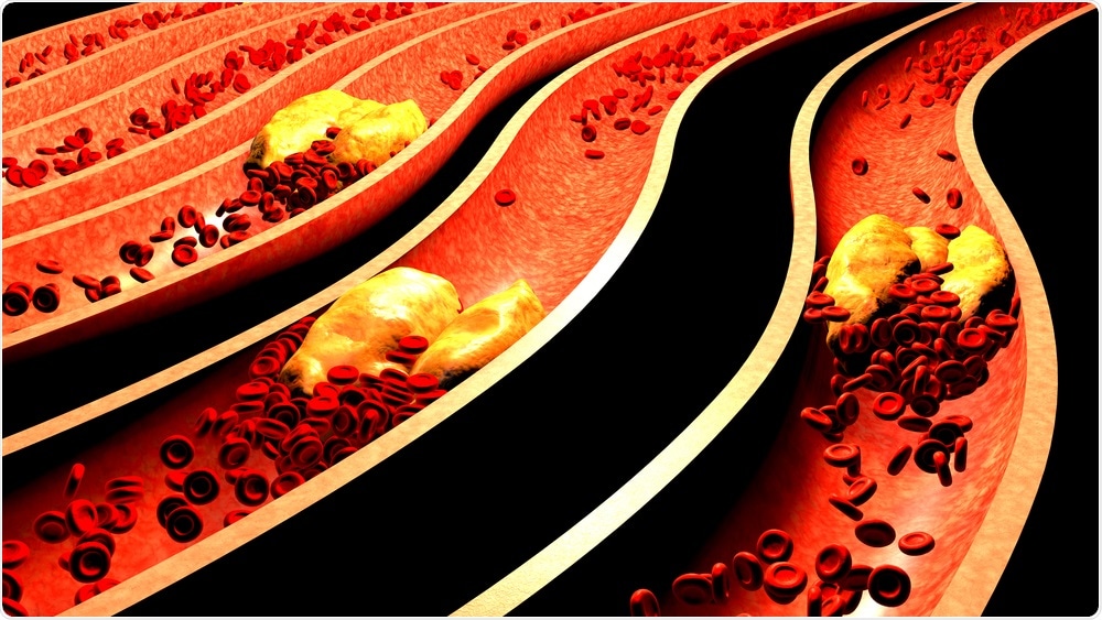 Cholesterol Cholesterol