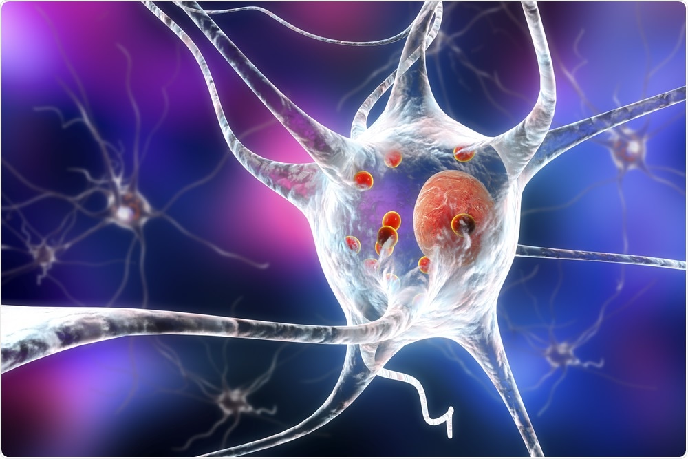 Parkinsons Disease Parkinsons Disease