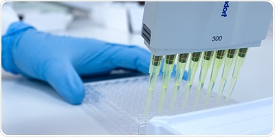 COVID-19 IgG Antibodies: Precise Measurement with the Kantaro COVID-SeroKlir Kit