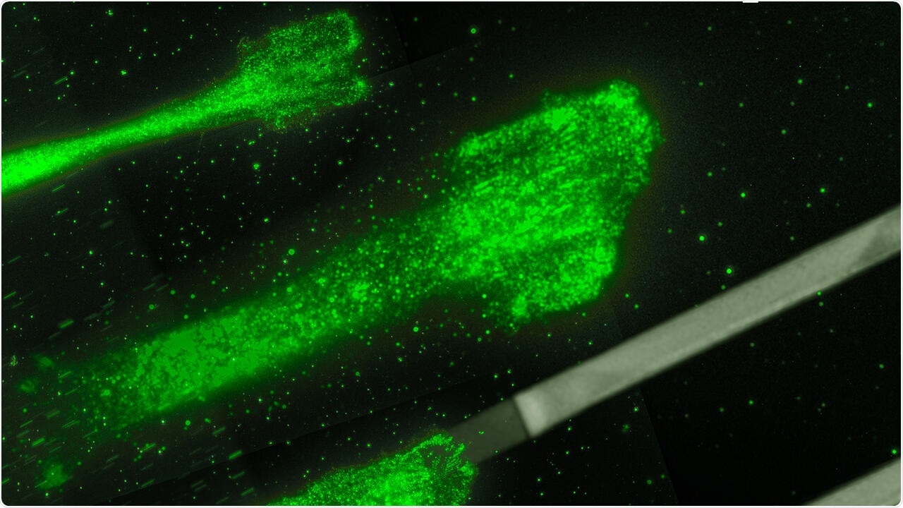 New mathematical model captures forces involved in cell movement