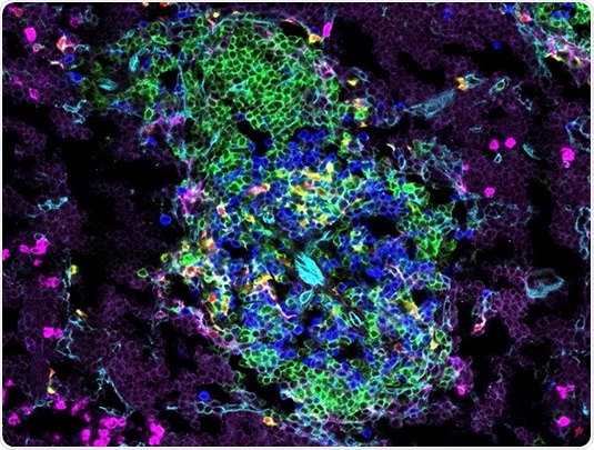 Immature dendritic cells in young children can induce robust immune responses