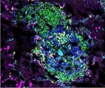 Immature dendritic cells in young children can induce robust immune responses