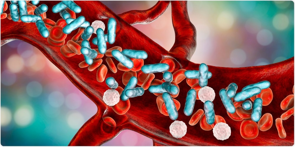 Sepsis Sepsis