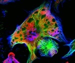 New CAR T therapy could be more effective and less toxic against neuroblastoma