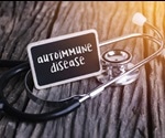 Researchers identify key molecule involved in immune regulation