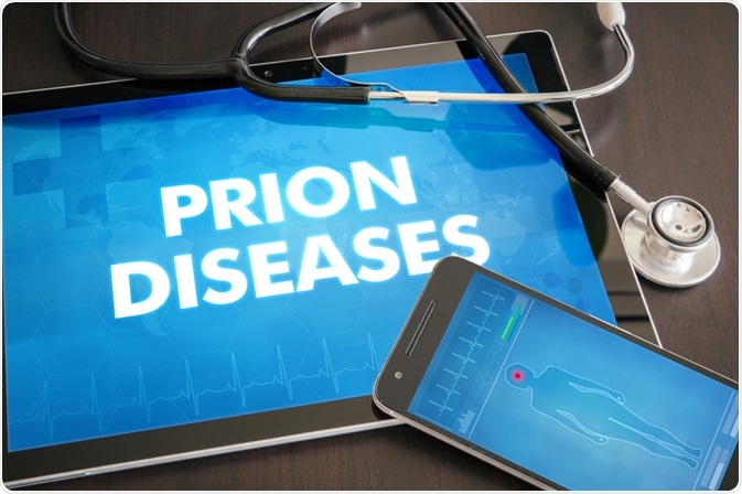 Prion Disease Prion Disease