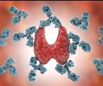 Study may lead to new treatments for autoimmune diseases