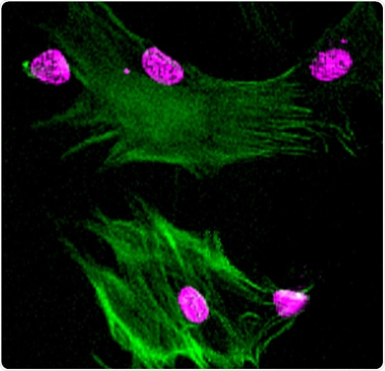 Researchers unravel impacts of protein BRD4 on how DNA folds