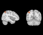 Researchers discover that existing drug can enhance memory