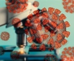 Study details metabolic processes employed by SARS-CoV-2 to attack lung tissue