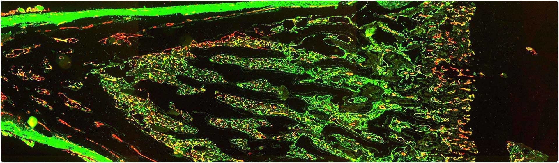 Study sheds light on blood and immune systems development in prenatal bone marrow