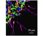 Cancer cells change their shape and migration modes more often, says research