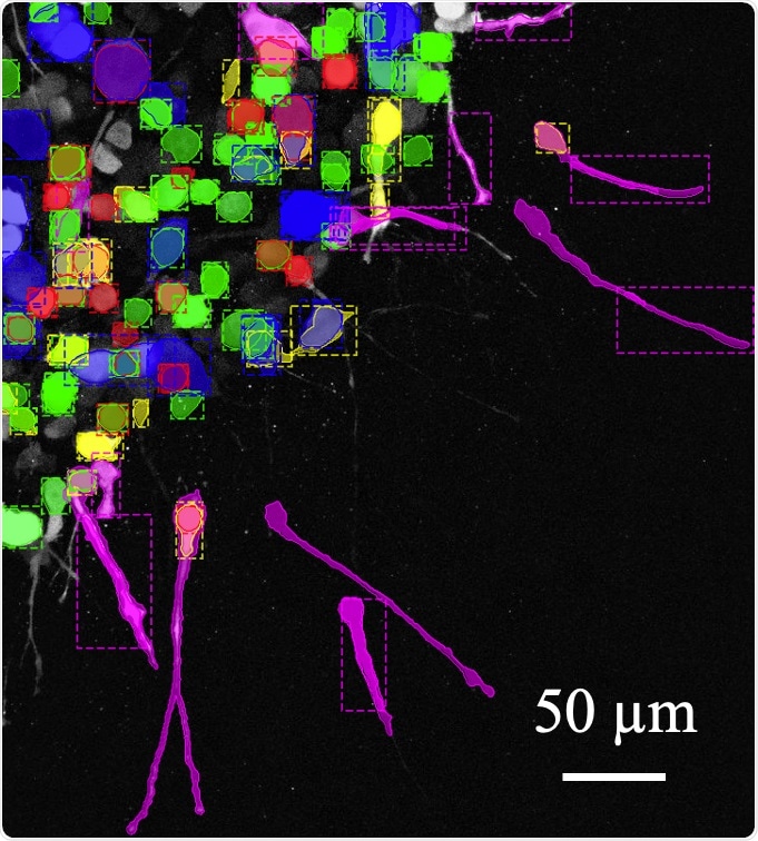Cancer cells change their shape and migration modes more often, says research