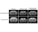 Specific amino acids act against neurodegenerative processes, says study