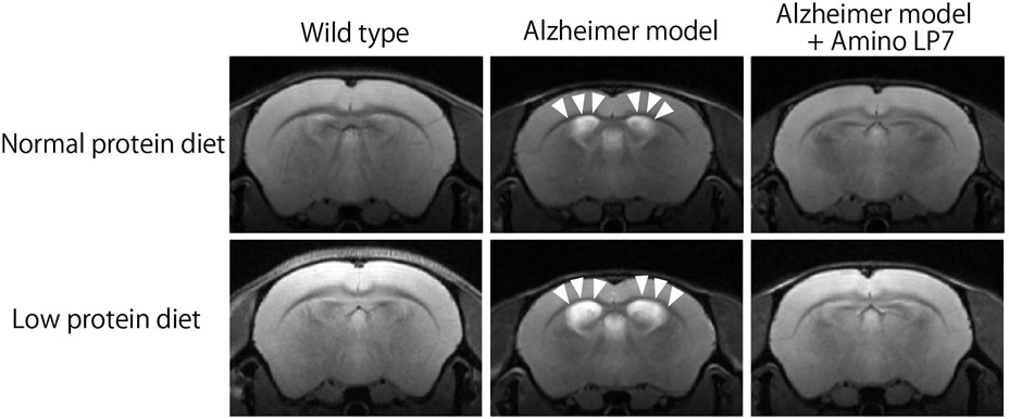 Specific amino acids act against neurodegenerative processes, says study