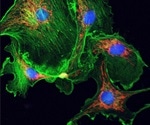 Researchers reveal how and why cytoquakes occur