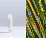 ioSkeletal Myocytes | New product launch