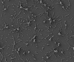 Experts create “living medicine” to combat biofilms on medical implants