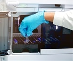 Applications of Fast Protein Liquid Chromatography (FPLC)