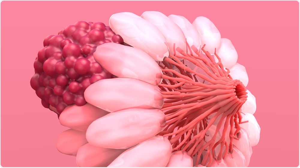 Breast Cancer Breast Cancer