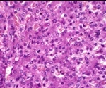 Stem Cell-Derived Hepatocytes: A Brave New World?