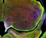 Applications of IVIS (In Vivo Imaging Systems)