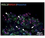 Researchers successfully generated Leydig cells from human iPS cells
