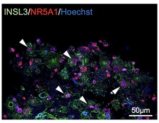 Researchers successfully generated Leydig cells from human iPS cells