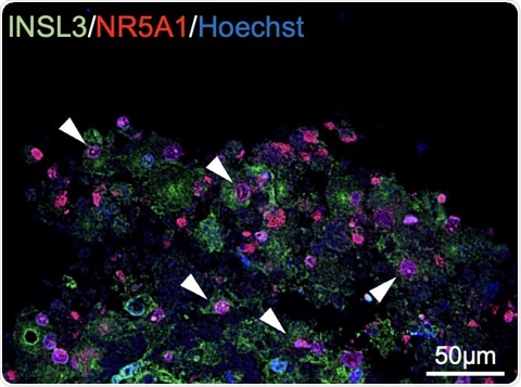 Researchers successfully generated Leydig cells from human iPS cells