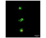 Apoptosis of mesenchymal stromal cells benefits therapeutic function